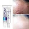 Bioaqua Pure Skin Acne Cream Price in Bangladedsh #Apsarah.com