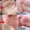 foot cream for dry skin foot cream for dry skin
