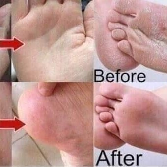 Banana Foot Cream 2 foot cream for dry skin